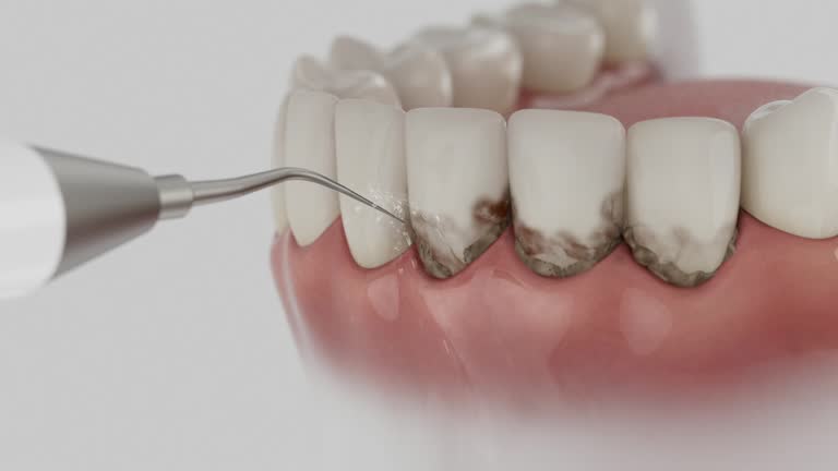 Reliable Dental Implants contractor in Mayodan, NC by Smile Center Dentistry